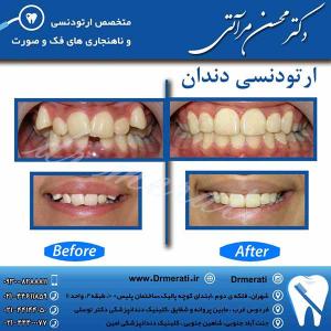 دکتر محسن مرآتی - متخصص ارتودنسی 